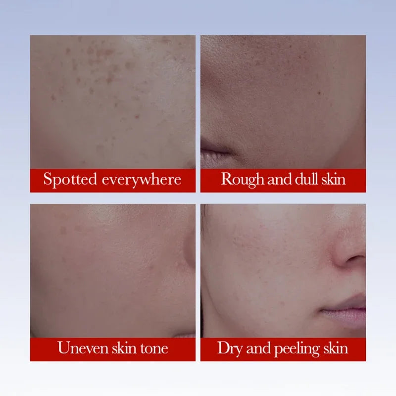 SADOER anti-freckle brightening face cream dark spot corrector