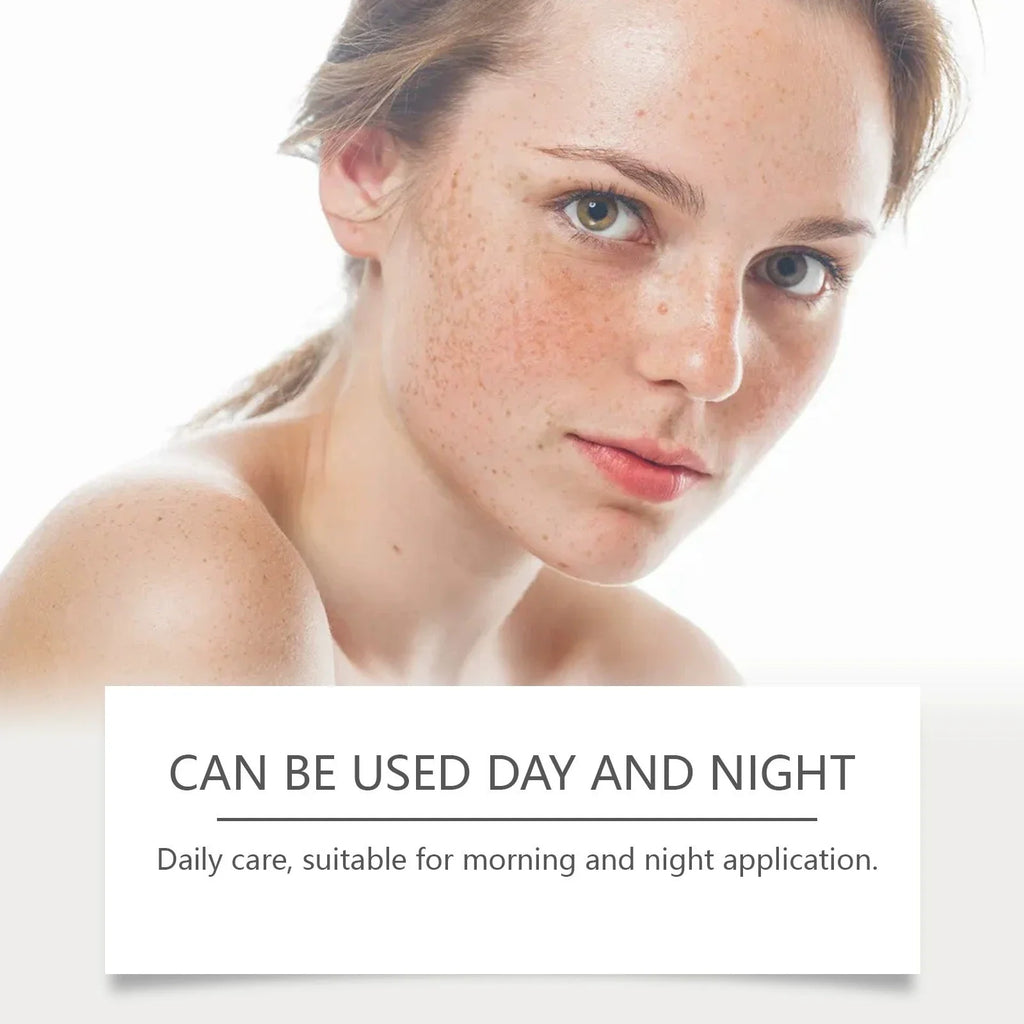 SADOER anti-freckle brightening face cream dark spot corrector